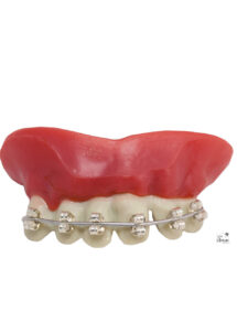 dentier humour, dentier appareil dentaire, dentier bagues, Dentier Bagues d’Appareil Dentaire, avec Pâte