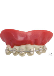 dentier humour, dentier appareil dentaire, dentier bagues